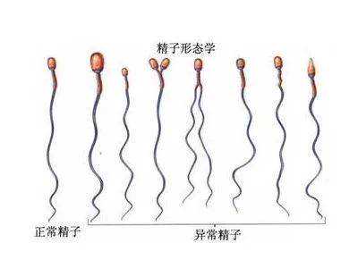 郑州代孕合法么，郑州女性的输卵管为什么会堵塞