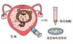 郑州代孕女孩包成功，郑州女性做输卵管造影的过程